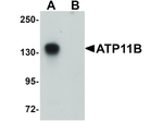 ATP11B Antibody in Western Blot (WB)