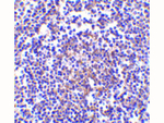 AVEN Antibody in Immunohistochemistry (Paraffin) (IHC (P))