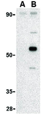 AVEN Antibody in Western Blot (WB)