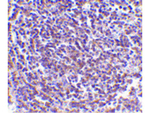 AVEN Antibody in Immunohistochemistry (Paraffin) (IHC (P))