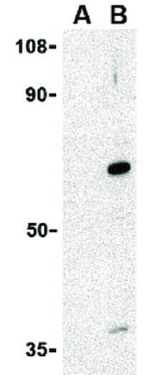 AVEN Antibody in Western Blot (WB)