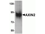 AXIN2 Antibody in Western Blot (WB)