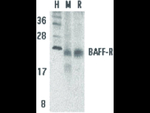 BAFF Receptor Antibody in Western Blot (WB)