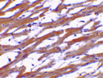 BAP29 Antibody in Immunohistochemistry (Paraffin) (IHC (P))