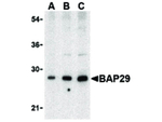 BAP29 Antibody in Western Blot (WB)