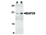 BAP29 Polyclonal Antibody