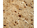 BAPX1 Antibody in Immunohistochemistry (Paraffin) (IHC (P))