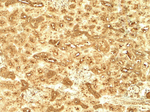 BATF3 Antibody in Immunohistochemistry (Paraffin) (IHC (P))