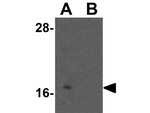 BATF3 Antibody in Western Blot (WB)