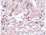 BCAS1 Antibody in Immunohistochemistry (Paraffin) (IHC (P))