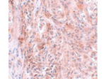 BCAS2 Antibody in Immunohistochemistry (Paraffin) (IHC (P))