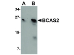 BCAS2 Antibody in Western Blot (WB)