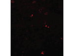 BCAS3 Polyclonal Antibody