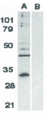 BCL10 Antibody in Western Blot (WB)