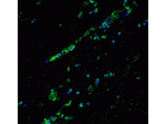 BCL9L Polyclonal Antibody