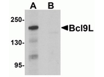 BCL9L Antibody in Western Blot (WB)
