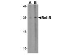 BCL-B Antibody in Western Blot (WB)