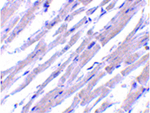 BCL-RAMBO Antibody in Immunohistochemistry (Paraffin) (IHC (P))