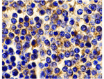 BCMA Antibody in Immunohistochemistry (Paraffin) (IHC (P))
