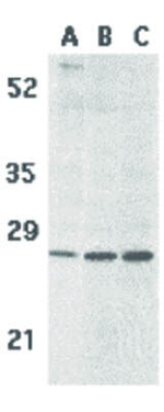 BCMA Antibody in Western Blot (WB)