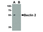 BECLIN2 Polyclonal Antibody