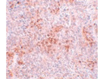 BFAR Antibody in Immunohistochemistry (Paraffin) (IHC (P))