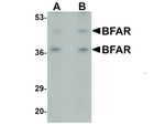 BFAR Antibody in Western Blot (WB)
