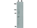 BICD1 Antibody in Western Blot (WB)