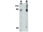 BICD2 Polyclonal Antibody