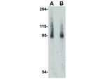 BICD2 Polyclonal Antibody