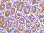 BIT1 Antibody in Immunohistochemistry (Paraffin) (IHC (P))