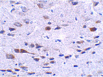 BORA Antibody in Immunohistochemistry (Paraffin) (IHC (P))