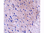 BORA Antibody in Immunohistochemistry (Paraffin) (IHC (P))