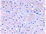 BRAL1 Antibody in Immunohistochemistry (Paraffin) (IHC (P))