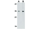 BRAL1 Antibody in Western Blot (WB)
