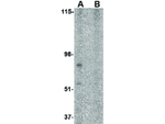 BRCC45 Antibody in Western Blot (WB)