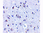 BRSK1 Antibody in Immunohistochemistry (Paraffin) (IHC (P))
