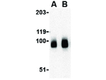 BRSK1 Antibody in Western Blot (WB)