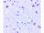 BRSK1 Antibody in Immunohistochemistry (Paraffin) (IHC (P))