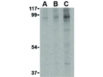 BRSK2 Antibody in Western Blot (WB)