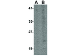 Bst2 Polyclonal Antibody