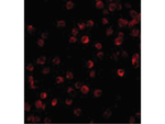 BTK Antibody in Immunocytochemistry (ICC/IF)