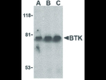 BTK Antibody in Western Blot (WB)