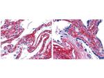 Collagen Type V Antibody in Immunohistochemistry (IHC)
