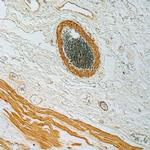 Actin, Smooth Muscle Antibody in Immunohistochemistry (Paraffin) (IHC (P))