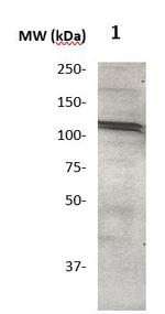 Androgen Receptor (AR) Antibody in Western Blot (WB)