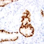 Phospho-P53 (Ser15) Antibody in Immunohistochemistry (Paraffin) (IHC (P))