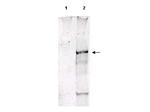 Phospho-ATM (Ser1981) Antibody in Western Blot (WB)