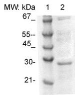 Tpd52 (Tumor Protein D52) Antibody in Western Blot (WB)