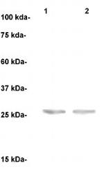 PSA Antibody in Western Blot (WB)